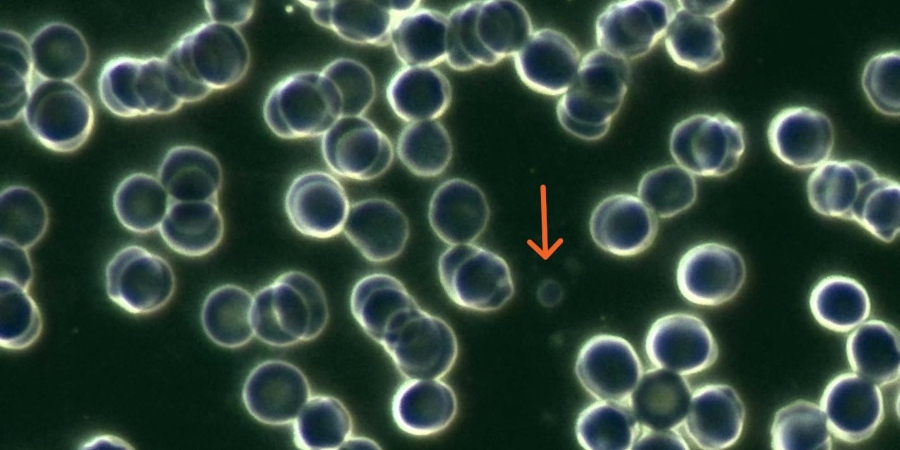 Qual a importância da microscopia